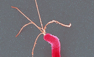 Helicobacter pylori – jak skomponować dietę dla chorego?